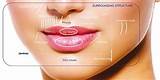 Pictures of Best Lip Augmentation Doctor
