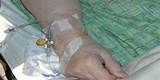 Intravenous Cancer Treatment Photos