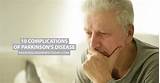 Parkinson''s Disease Symptoms Mayo Clinic Photos