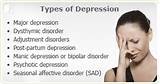 Images of Depression Types