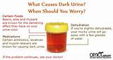 Images of What Medications Can Cause Blood In Urine
