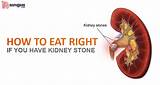 Photos of Kidney Stone Doctor