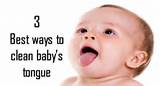 Thrush In Newborns Home Remedies Photos