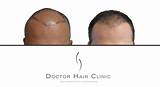 Images of Hair Loss Doctor Nj