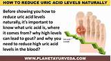 Photos of Uric Acid Pain Relief Home Remedies