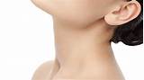 Goiter Home Remedies Pictures