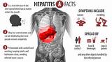 Photos of Treatment For Hep B Infection