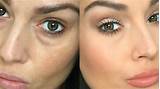 How To Cover Up Dark Circles Under Eyes With Makeup Photos