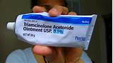 Pictures of Triamcinolone Ointment Tube Size