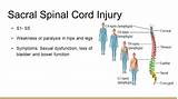 Pictures of Spinal Cord Injury Hospital