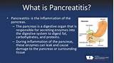 Can Pancreatitis Cause Liver Damage Pictures