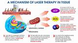 Low Level Laser Therapy Side Effects Photos