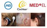 Advanced Bionics Cochlear Implant Mri Photos