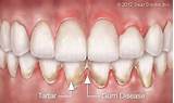 Centerville Family Dental Ma Images