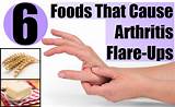 Home Remedies Arthritis Foot Pain