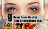 Pictures of Effective Home Remedies For Dark Circles