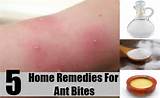 Photos of Ant Remedies