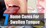 Jaw Swelling Home Remedies