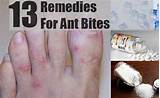 Fire Ants Bite Remedy