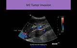 Ultrasound Course Online Images