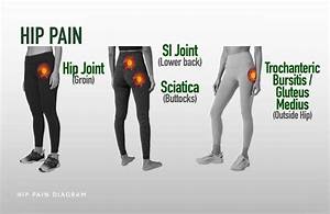 Various Causes Of Hip A Blog Post From Emed