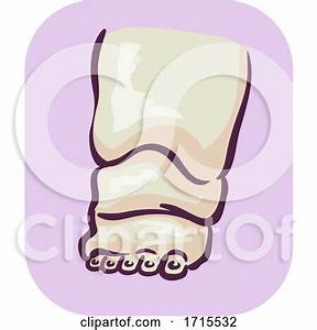 Symptom Feet Enlargement Illustration By Bnp Design Studio 1715532