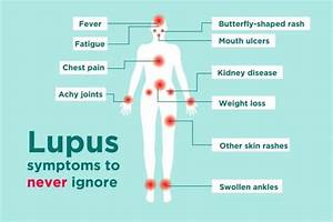 Signs And Symptoms Of Lupus Lupus Association Of Nsw Inc