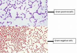 Gram Staining Principle Procedure And Results