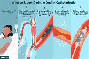 Cardiac Catheterization Clipart Full Size Clipart 5358792 Pinclipart