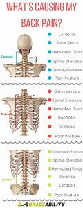 Pin On Back Injuries Spine Disorders What 39 S Causing My Back 
