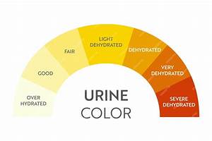 Premium Vector Urine Color Chart Hydration And Dehydration Test