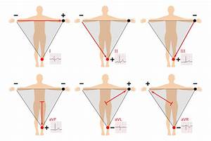 12 Lead Ecg Placement Guide With Illustrations