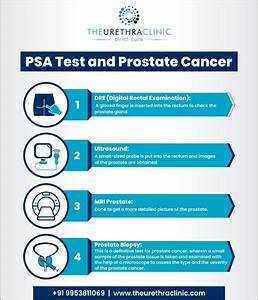Psa Testing And Cancer Advised For Men Aged 50 And Above