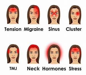 Location Different Types Of Headaches And Causes Sally Stewart