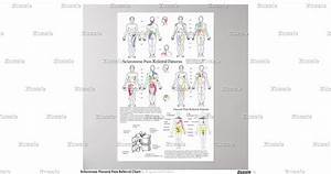 Sclerotome Visceral Referral Chart Poster