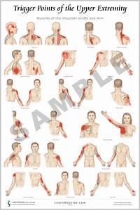 Trigger Point Upper Extremity 24 Quot X 36 Quot Premium Poster 2 Pack Learn