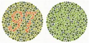 A Test Plate Of The Well Known Ishihara Colour Vision Test Left The