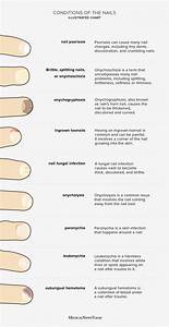 Nail Health Chart Common Problems And How To Treat Them