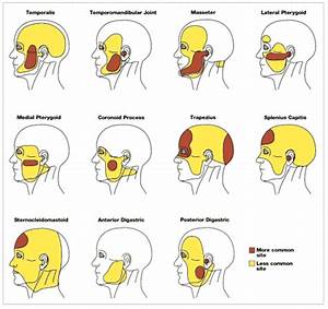 Referred Dental It Hurts But Where And Why There