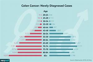 Chances Of Colon Cancer Under 30 Cancerwalls