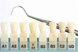 Tooth Color Chart Stock Photos Pictures Royalty Free Images Istock