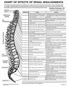 Chiropractic Chart Of Effects Of Spinal Misalignments Health Home