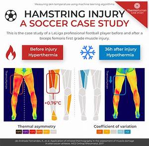 Hamstring Injury A Soccer Case Study Thermohuman