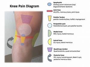 Inside Knee Diagnosis Chart