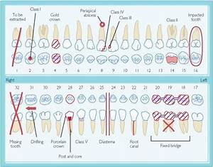 Stimulating Dental Crown Front Teeth Dentalimplantssurgery
