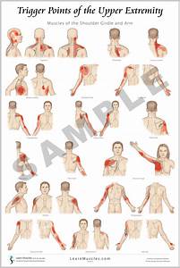 Trigger Point Upper Extremity 24 Quot X 36 Quot Premium Poster 2 Pack Learn