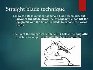 Pediatric Airway Chart