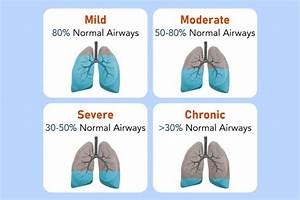 Stages Of Copd Chart