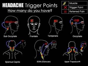 17 Best Images About Trigger Points On Pinterest Low Back