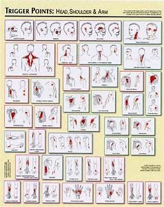 Trigger Point Charts Clinical Charts And Supplies